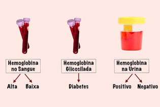 Imagen ilustrativa del artículo Hemoglobina: qué es, por qué está alta o baja y valores normales