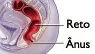 Imagen ilustrativa del artículo Prolapso rectal en niños: causas y tratamiento