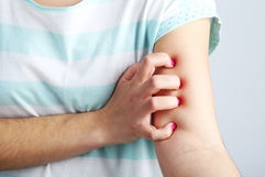 Imagen ilustrativa del artículo ¿Por qué me pica el cuerpo en las noches?