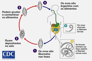 Imagem ilustrativa do artigo Tricuríase (Trichuris trichiura): o que é, sintomas e tratamento