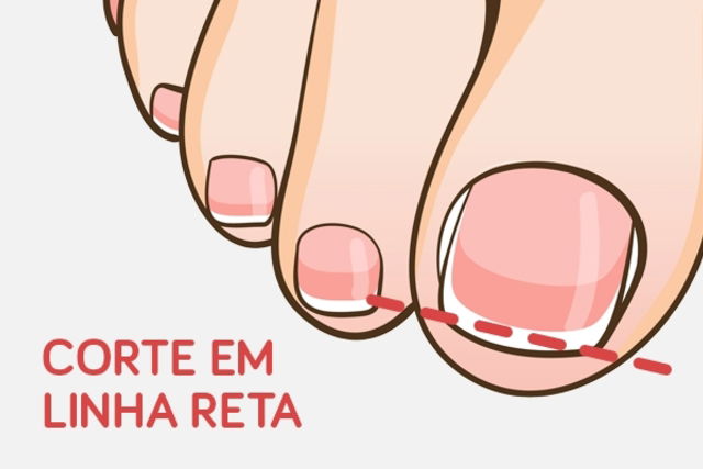 Imagem ilustrativa número 1