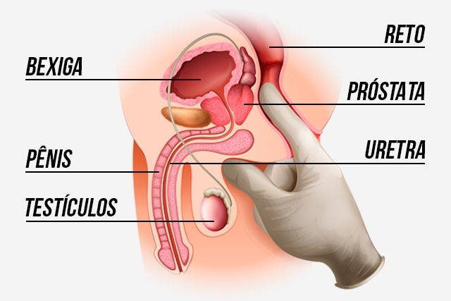 Imagem ilustrativa número 1