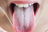 Illustrative image of the article White Tongue: 6 Causes & How to Get Rid of It