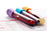 Illustrative image of the article CEA Blood Test: What It Tests & Normal Levels 