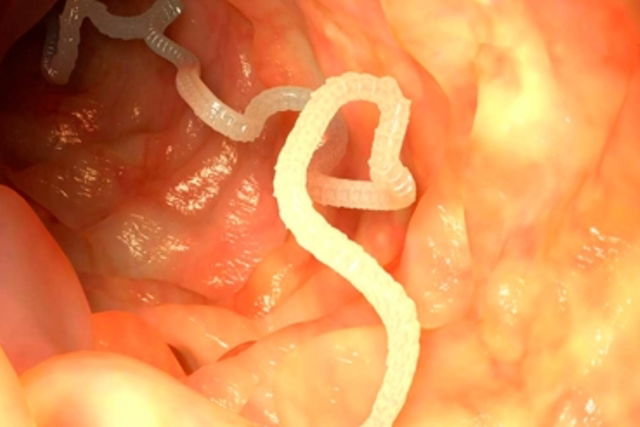 Illustrative image of the article 10 Parasite Symptoms (w/ Online Symptoms Quiz) & Treatment