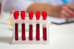 Imagen ilustrativa del artículo Progesterona alta o baja: por qué puede ocurrir y valores normales