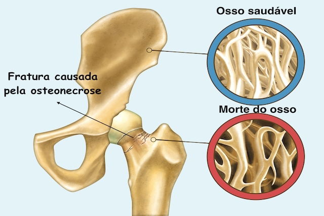 Imagem ilustrativa número 1