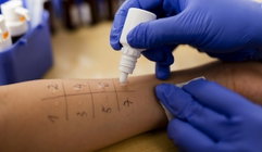 Illustrative image of the article Allergy Testing: Types, Preparation & When It’s Recommended