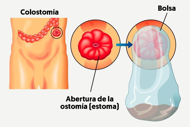 Imagem ilustrativa número 1