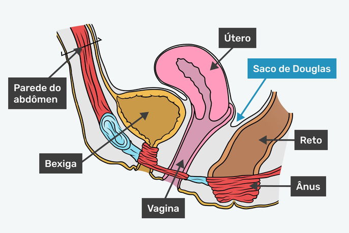 Imagem ilustrativa número 2