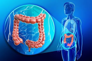 Imagem ilustrativa do artigo Câncer de intestino tem cura? 4 opções de tratamento