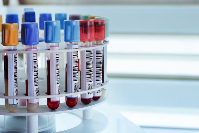 Illustrative image of the article Blood Test for Anemia: 8 Exams to Help Confirm a Diagnosis