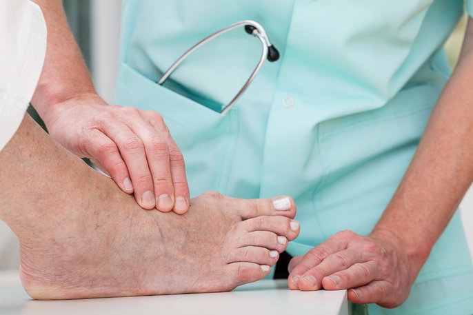 healthcare provider checking for arterial ulcers