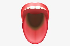 Imagen ilustrativa del artículo Qué puede tornar la lengua marrón, morada, blanca, amarilla, roja o negra