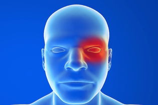 Illustrative image of the article Cluster Headaches: Symptoms, Diagnosis, Causes & Treatment