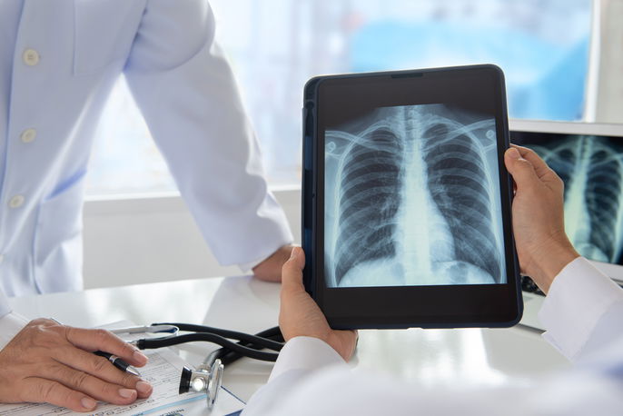 Doctors assessing chest x-ray