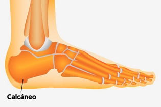 Imagen ilustrativa del artículo Dolor en el talón: 7 causas y qué hacer