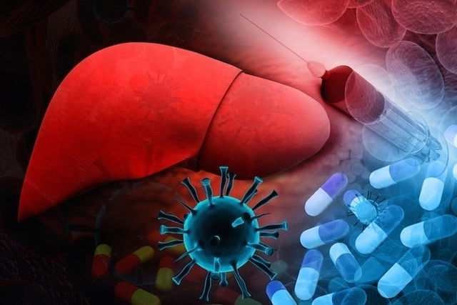 Imagen ilustrativa del artículo Varices esofágicas: causas, síntomas y tratamiento