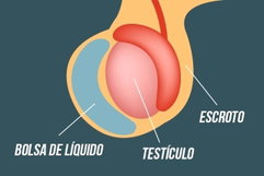 Illustrative image of the article Lump on Testicle: 7 Possible Causes (& How to Treat)
