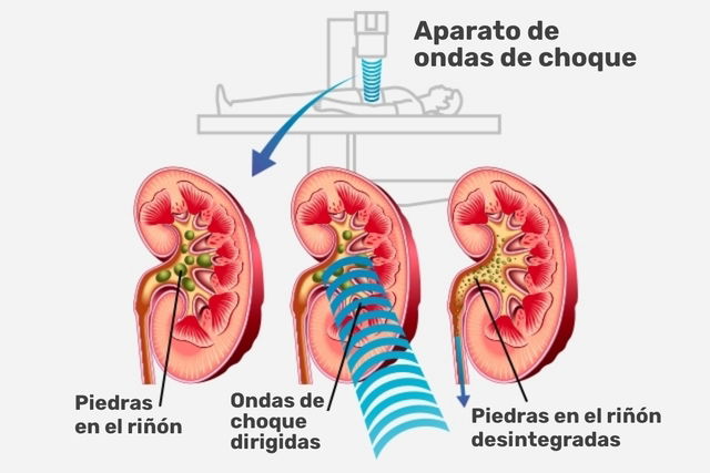 Imagem ilustrativa número 2