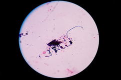 Imagem ilustrativa do artigo Coloração de Gram: o que é, para que serve (e passo a passo)