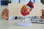 Image illustrative de l'article Extrasystole: symptômes, types, causes (et traitement)