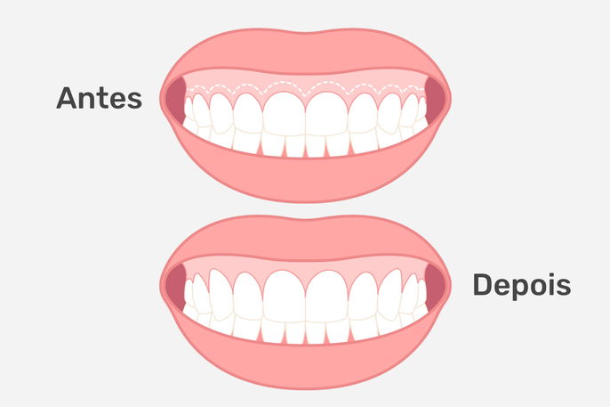 Imagem ilustrativa número 2