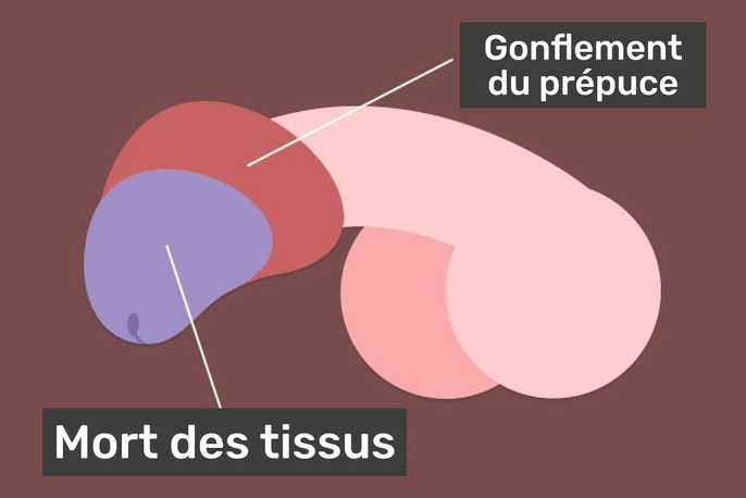 Imagem ilustrativa número 3