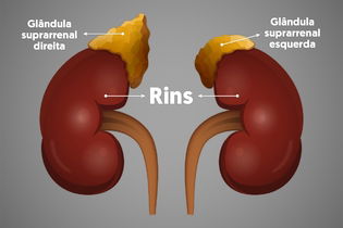 Illustrative image of the article Addison's Disease: Symptoms, Diagnosis, Causes & Treatment