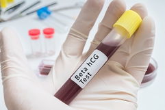 Illustrative image of the article HCG Blood Test: What Results Mean (& Difference From Urine Test)