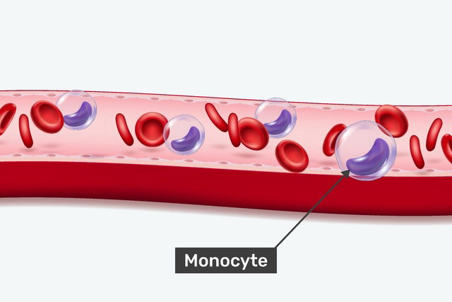 monocyte au milieu de globules rouges dans un vaisseau sanguin