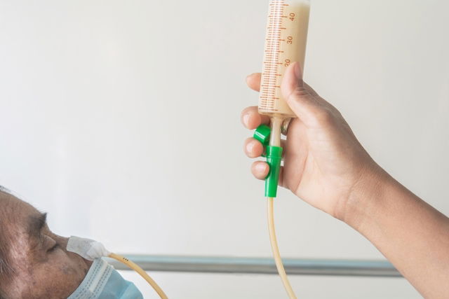 Nurse feeding via NG tube