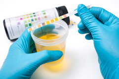 Image illustrative de l'article Cellules épithéliales dans l'urine: 4 causes (et que faire)