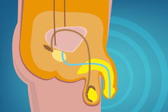 Imagen ilustrativa del artículo Eyaculación retrógrada: qué es, síntomas y tratamiento