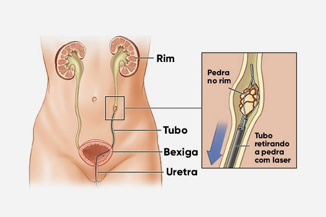 Imagem ilustrativa número 1