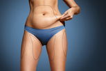 Illustrative image of the article Skinny Fat: Causes, Health Risks & What to Do