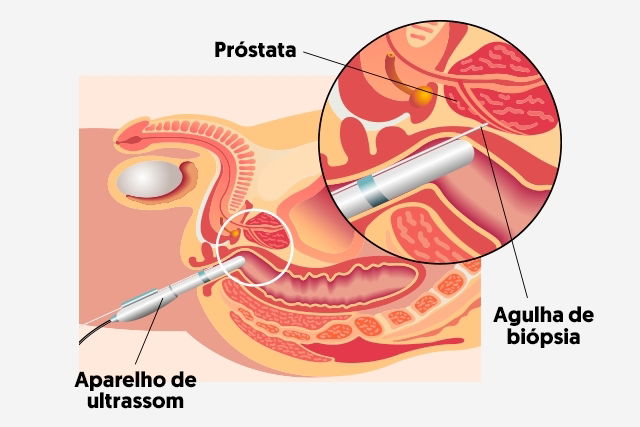 Imagem ilustrativa número 2