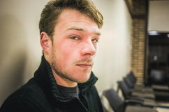 Illustrative image of the article Rash on Face: Contact Dermatitis, Allergies & More