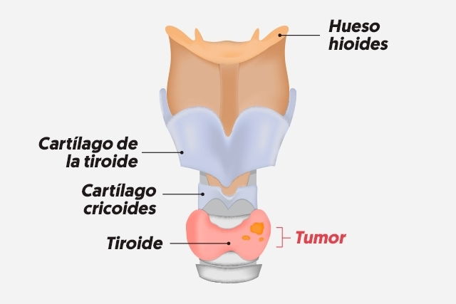 Imagem ilustrativa número 2