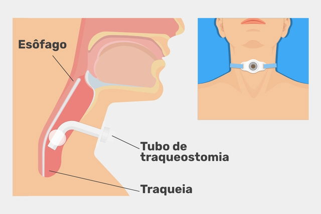 Imagem ilustrativa número 1