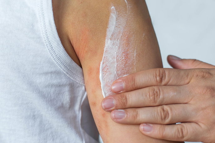 Imagem ilustrativa número 1