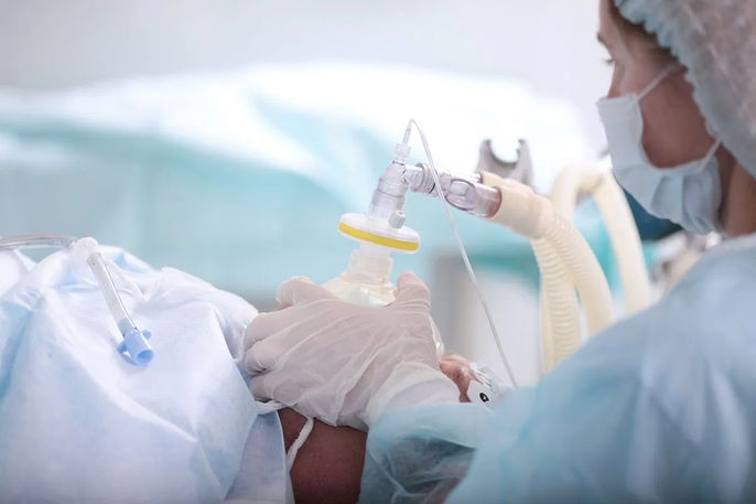 Médico anestesiólogo aplicando un anestésico por vía inhalatoria a un paciente