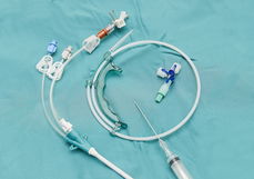 Imagen ilustrativa del artículo Catéter venoso central: qué es, para qué sirve y colocación 