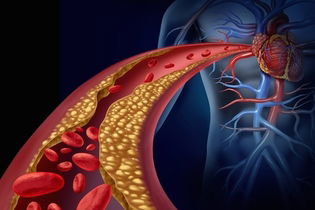 Imagem ilustrativa do artigo Lipidograma (exame de perfil lipídico): o que é e o que indica