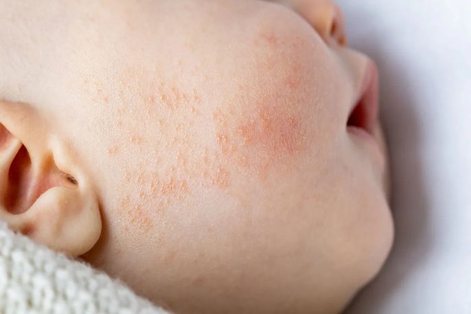 Imagem ilustrativa número 7