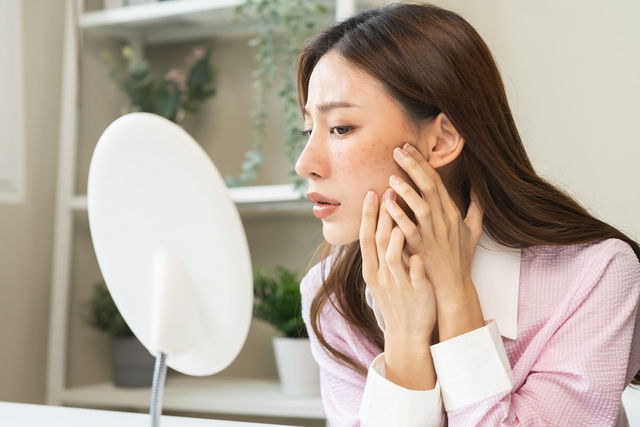 femme regardant ses taches marron sur le visage dans un miroir 