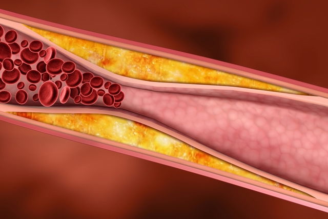 Imagen ilustrativa del artículo 7 síntomas de trombo en la pierna (incluye test online)