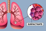 Imagen ilustrativa del artículo Surfactante pulmonar: qué es y cuál es la función