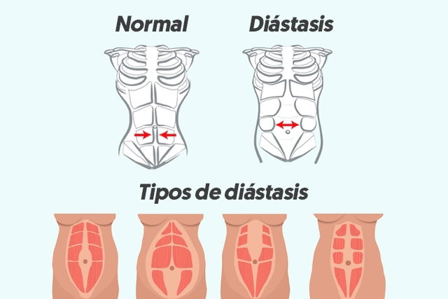 Imagem ilustrativa número 1