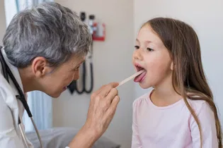 Imagem ilustrativa do artigo Amigdalite bacteriana: o que é, sintomas, causas e tratamento